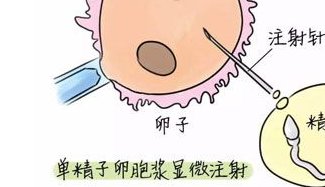 排卵障碍不容忽视，不孕大多是其原因！招远市哪家医院擅长排卵障碍试管方案？