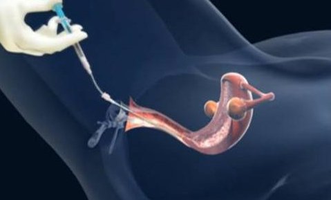 试管婴儿前期检查的时间规划与详尽指南