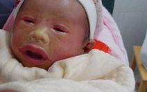 三代试管的基因筛查技术有哪些？