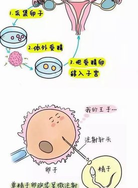 基础卵泡少做试管成功的可能性大吗？ 基础卵泡数量少怎么怀孕？